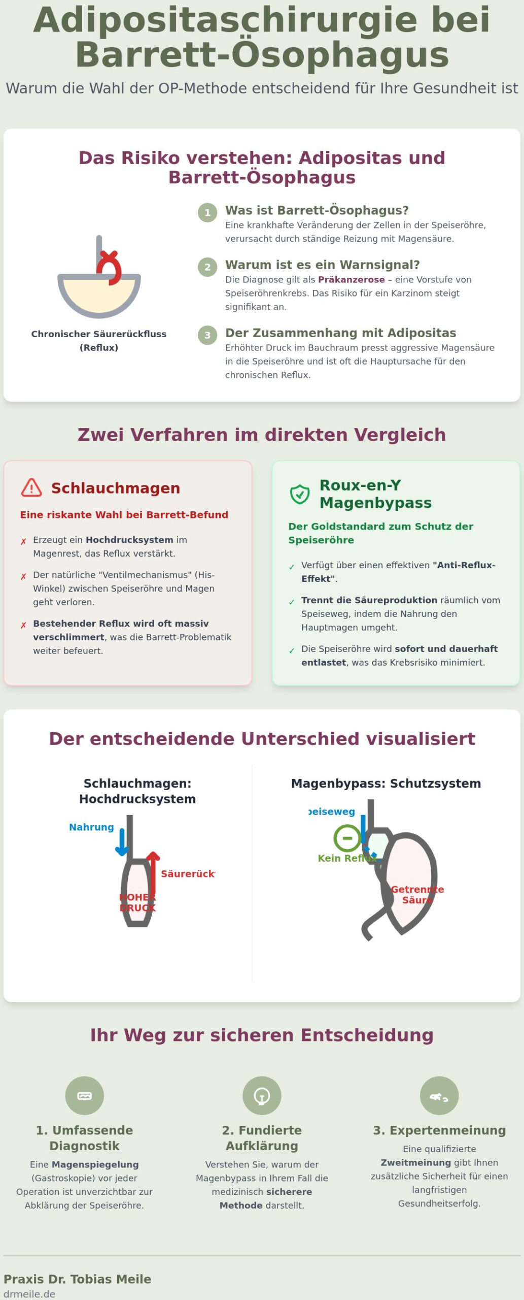 Barrett-Ösophagus: Warum Bypass statt Schlauchmagen?