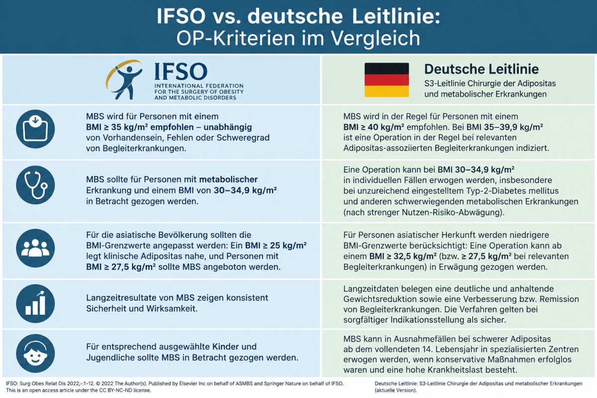 IFSO vs. deutsche Leitlinie: OP-Kriterien im Vergleich