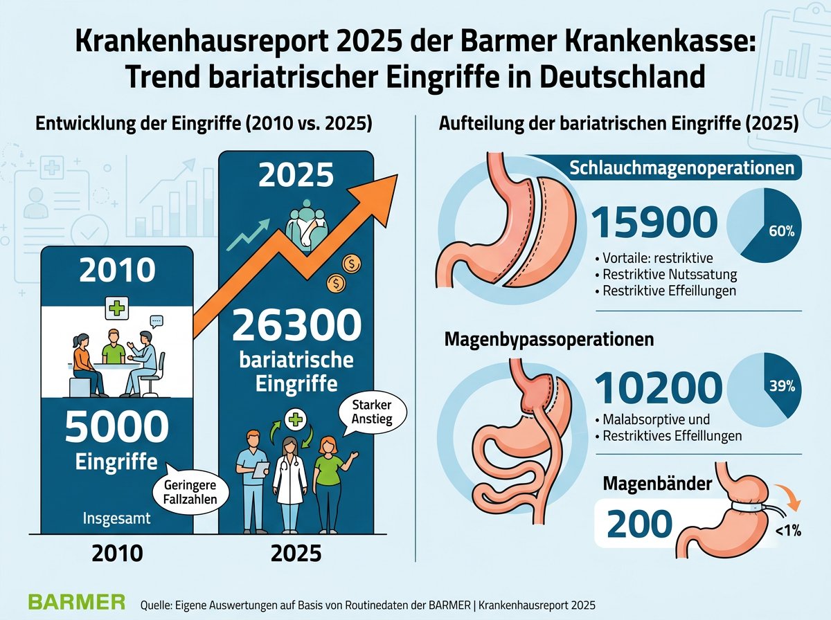 Kosten Magenverkleinerung Krankenkasse: Voraussetzungen & Übernahme 2026